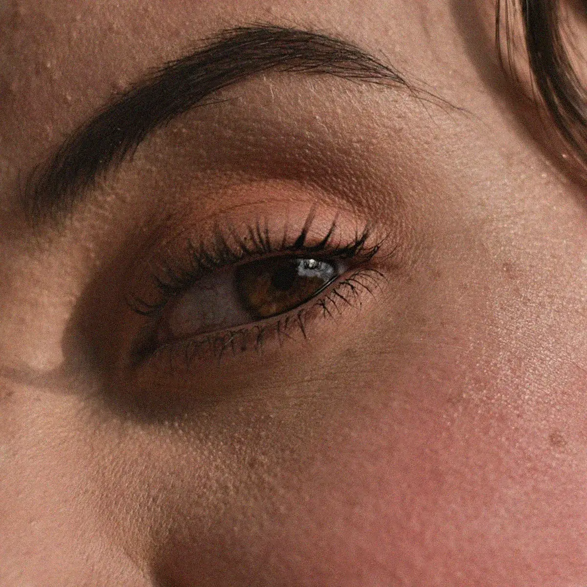 Uneven tone, after a peel course, before