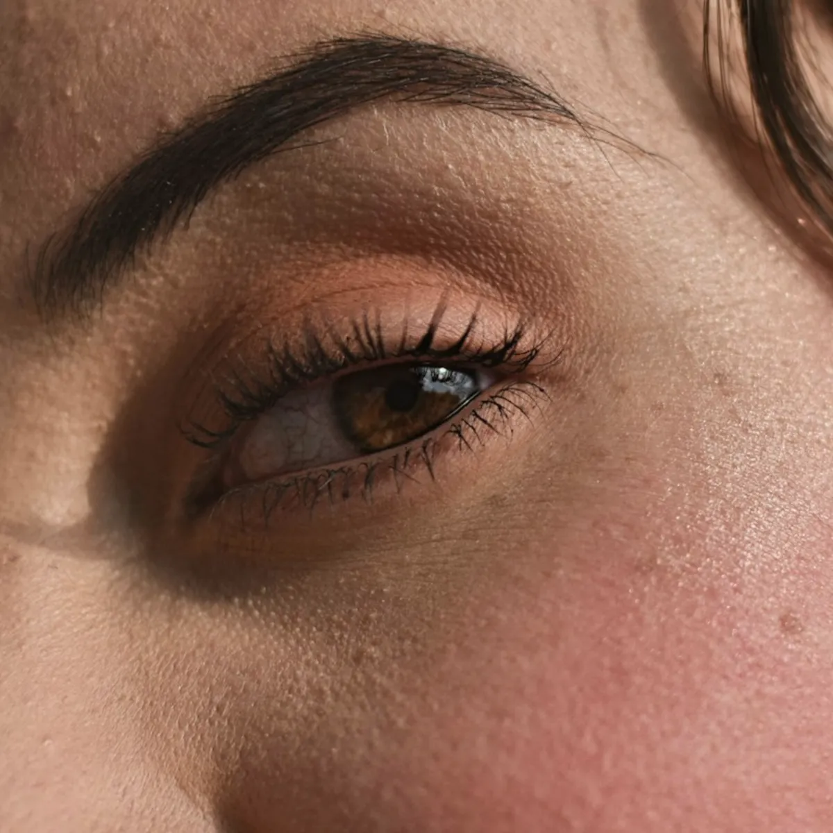 Uneven tone, after a peel course, after