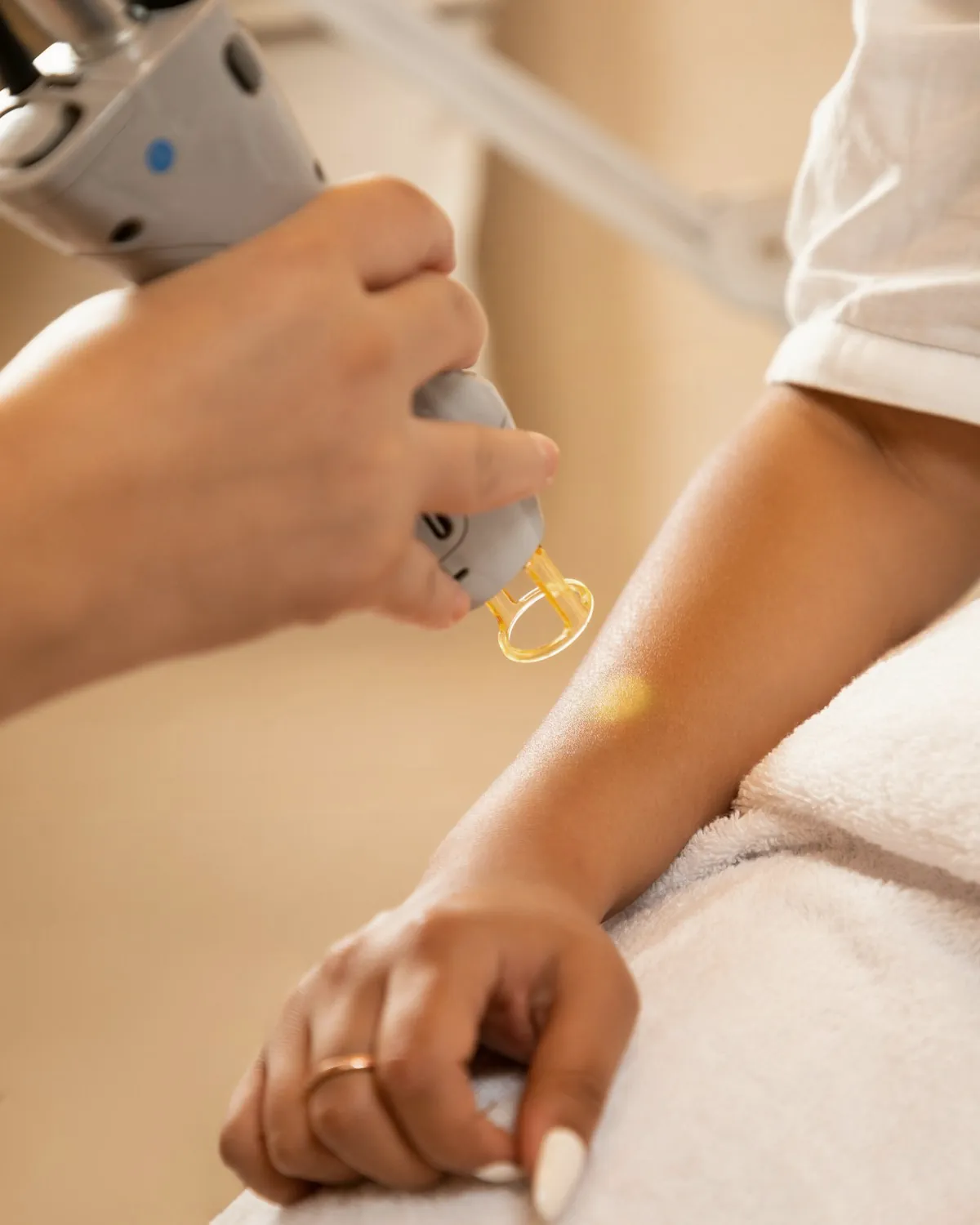 Fractional resurfacing at Soom